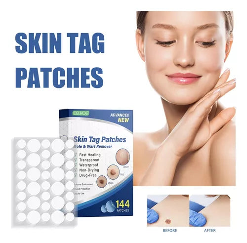 Skin Tag- Parches removedores de verrugas (144 un)