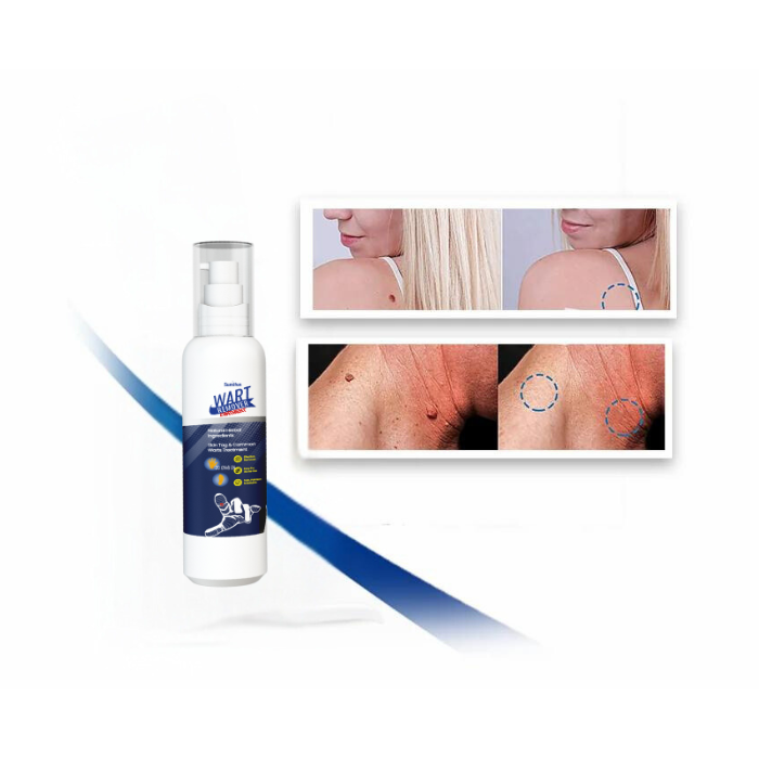 Removedor de verrugas- WART REMOVER 30 ml