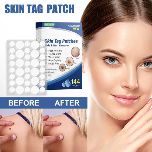 Skin Tag- Parches removedores de verrugas (144 un)