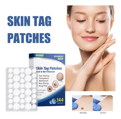 Skin Tag- Parches removedores de verrugas (144 un)
